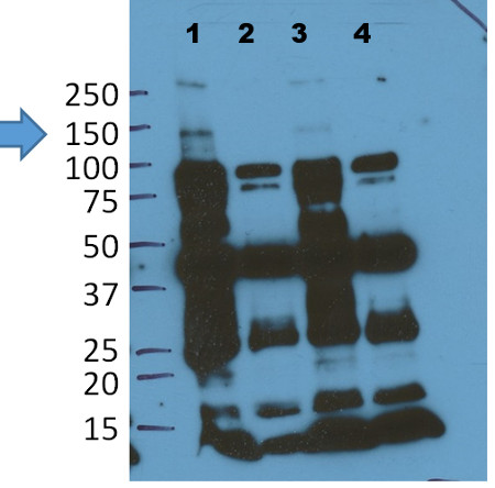 western blot using anti-EIN2 antibodies